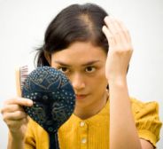 alopecia femminile